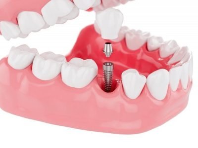 a4298f0a2cd37462b7d196f8accbbd36